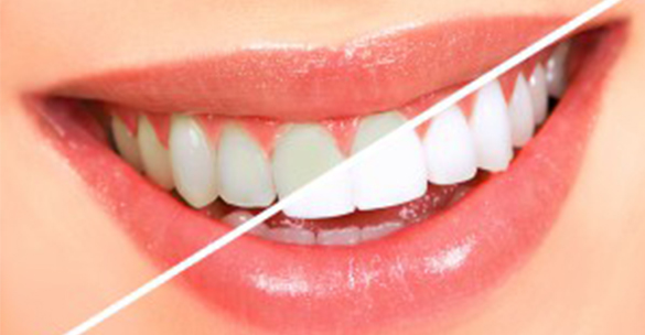 How to Handle Dental Emergencies?